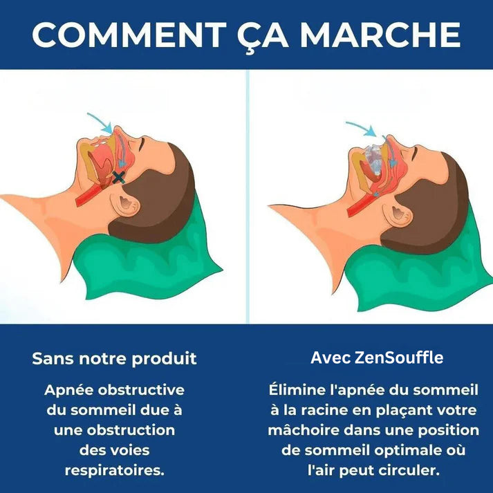 ZenSouffle™ Dispositif contre le ronflement et l'apnée du sommeil