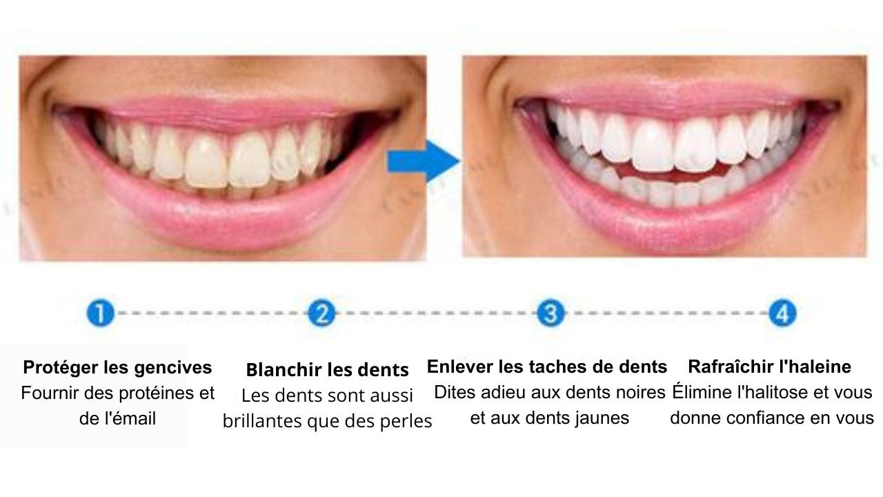 Serum de blanchiment des dents