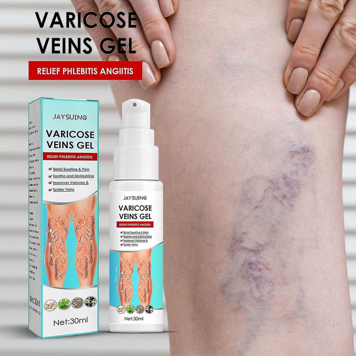 Spray de traitement des varices cicatrisantes